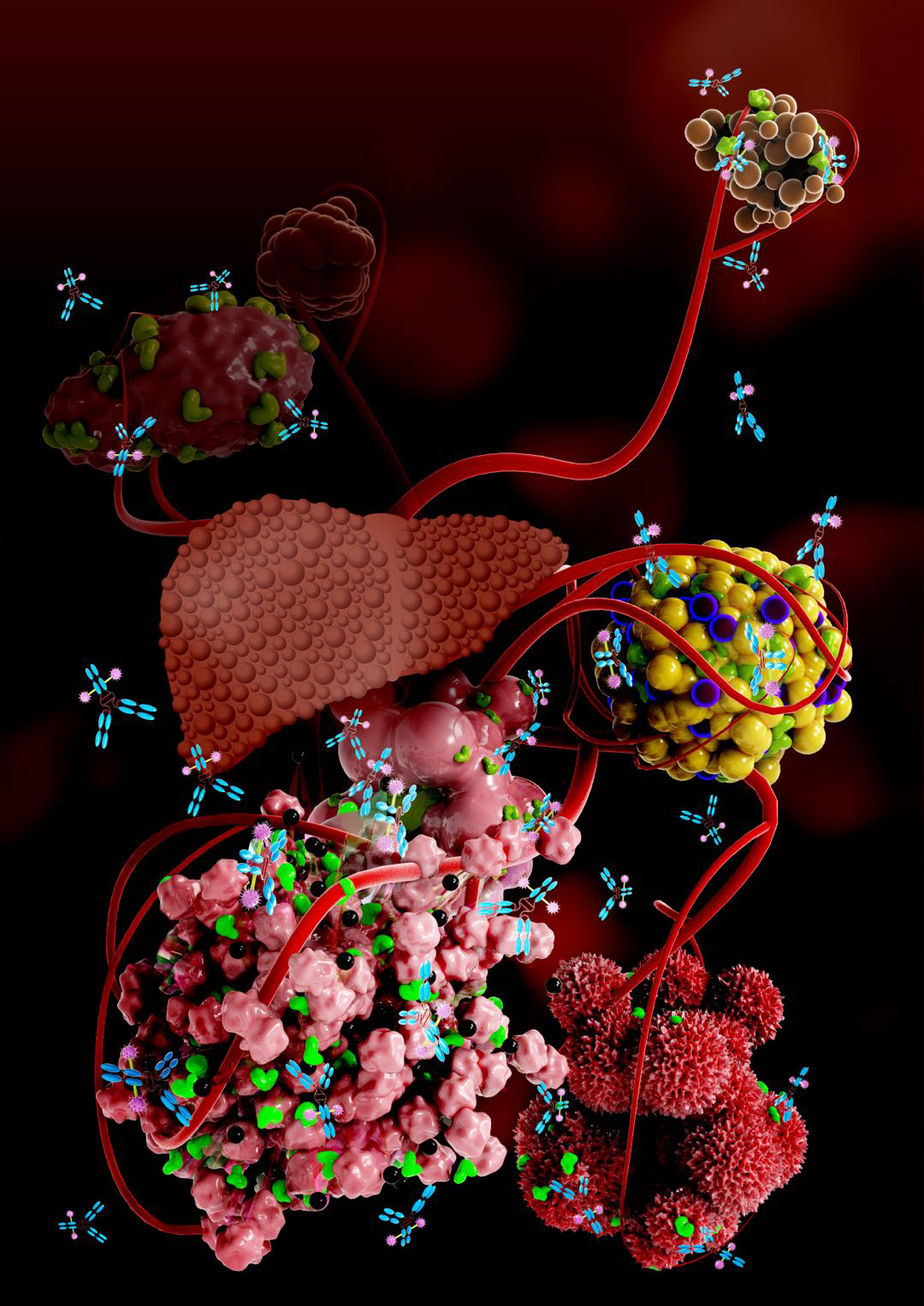Liver Cirrhosis, Hepatocellular Carcinoma and Cholangiocarcinoma